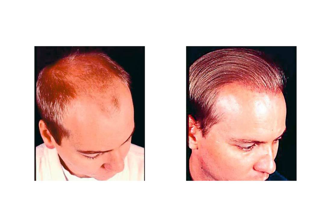 cabello_03