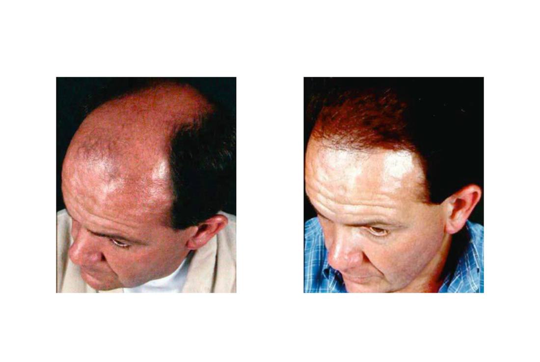cabello_04