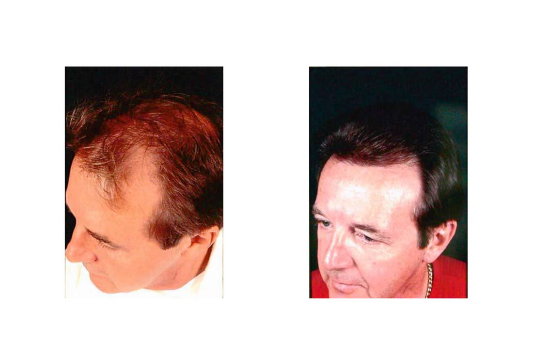 cabello_05