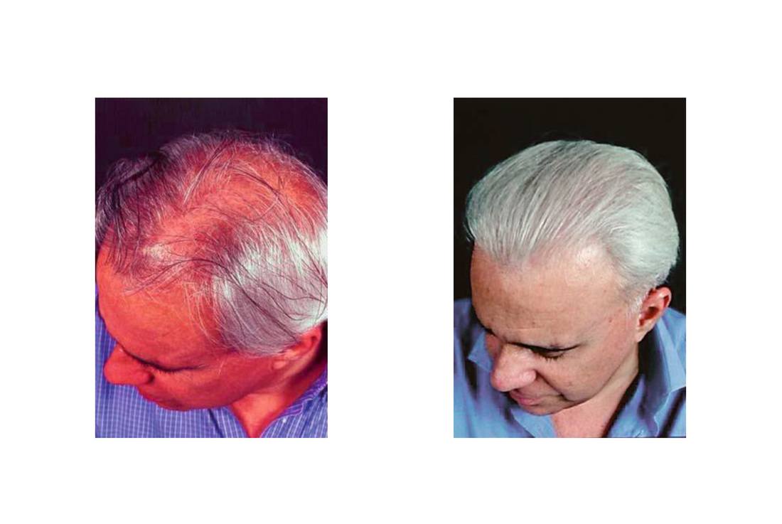 cabello_06