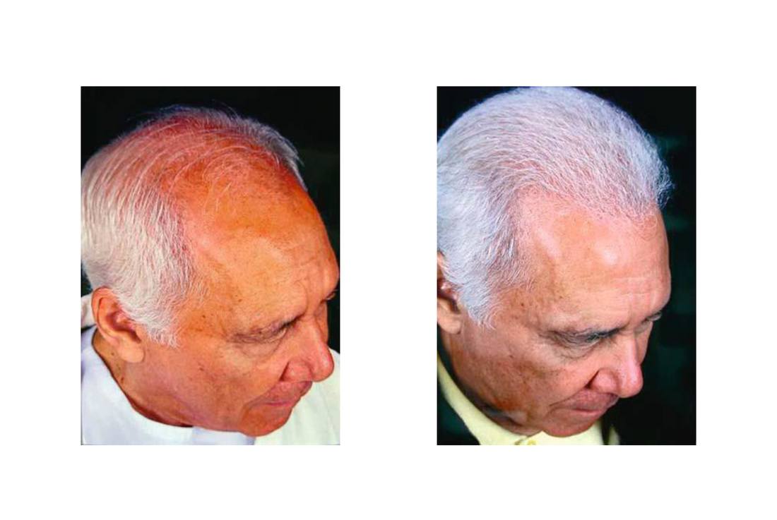 cabello_07