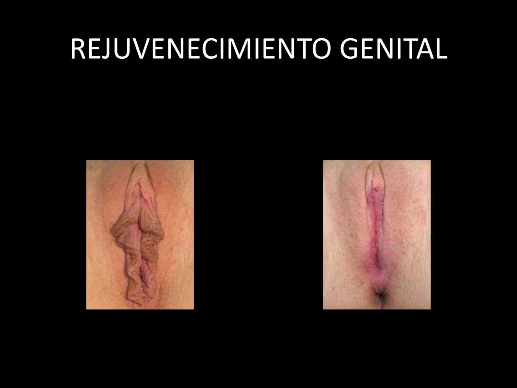 vagina_03