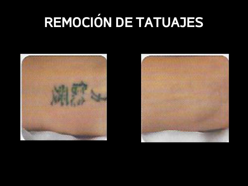 tatuajes_03